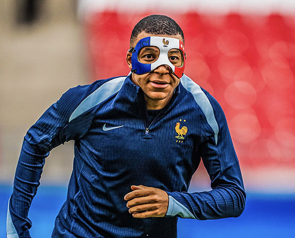 Euro – Rebondissement avant France-Pays Bas : L’Uefa dit non au masque de Mbappé